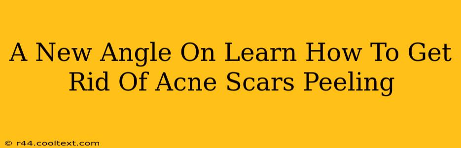 A New Angle On Learn How To Get Rid Of Acne Scars Peeling