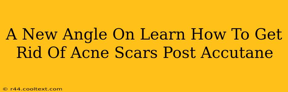 A New Angle On Learn How To Get Rid Of Acne Scars Post Accutane