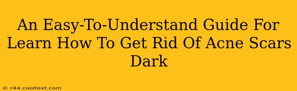 An Easy-To-Understand Guide For Learn How To Get Rid Of Acne Scars Dark