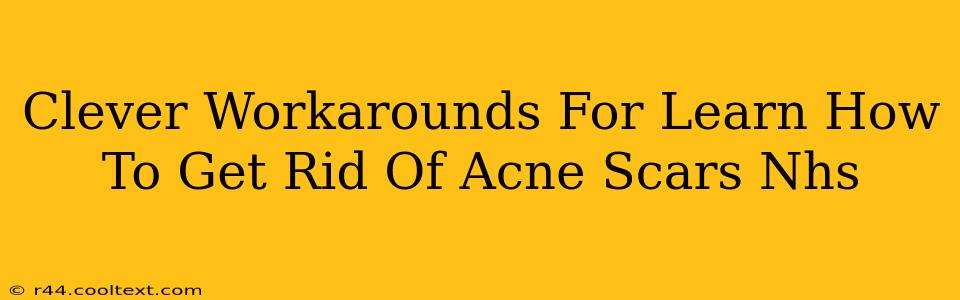 Clever Workarounds For Learn How To Get Rid Of Acne Scars Nhs