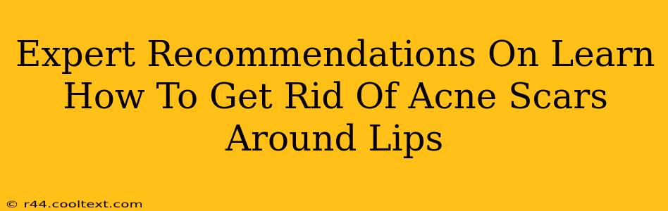 Expert Recommendations On Learn How To Get Rid Of Acne Scars Around Lips