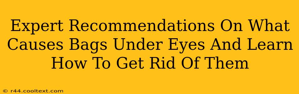 Expert Recommendations On What Causes Bags Under Eyes And Learn How To Get Rid Of Them