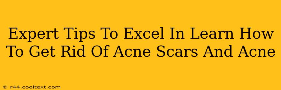 Expert Tips To Excel In Learn How To Get Rid Of Acne Scars And Acne