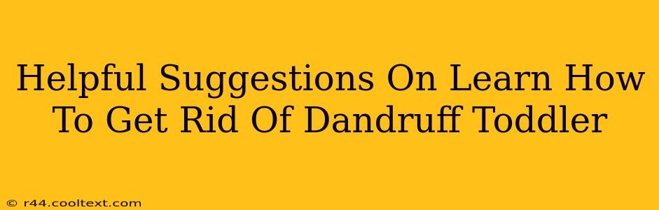 Helpful Suggestions On Learn How To Get Rid Of Dandruff Toddler