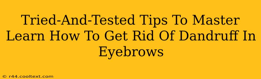 Tried-And-Tested Tips To Master Learn How To Get Rid Of Dandruff In Eyebrows